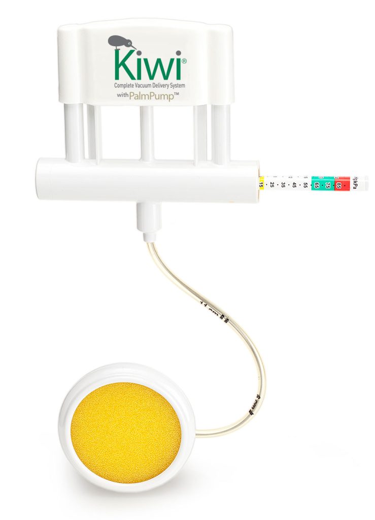 Sistema de parto asistido por vacío Kiwi