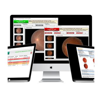 EyeArt - Sistema de Detección de Retinopatía Diabética con IA