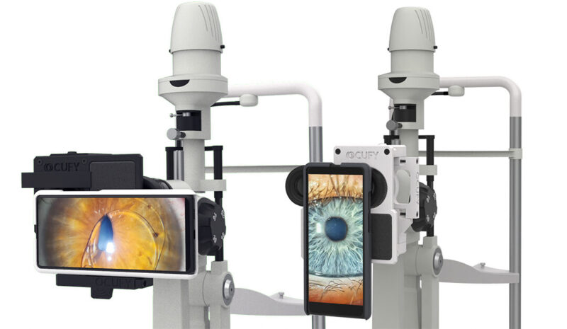 OCUFY: Soporte digitalizador para lámpara de hendidura