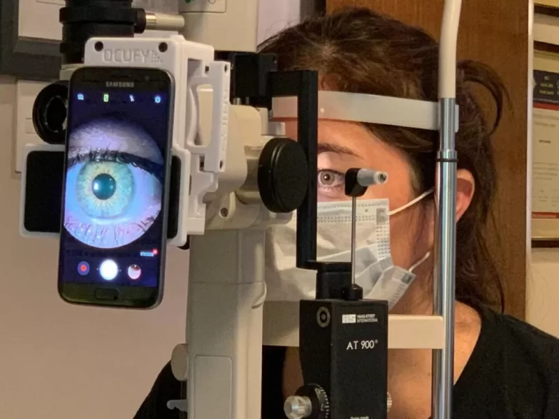 OCUFY: Soporte digitalizador para lámpara de hendidura - Imagen 4