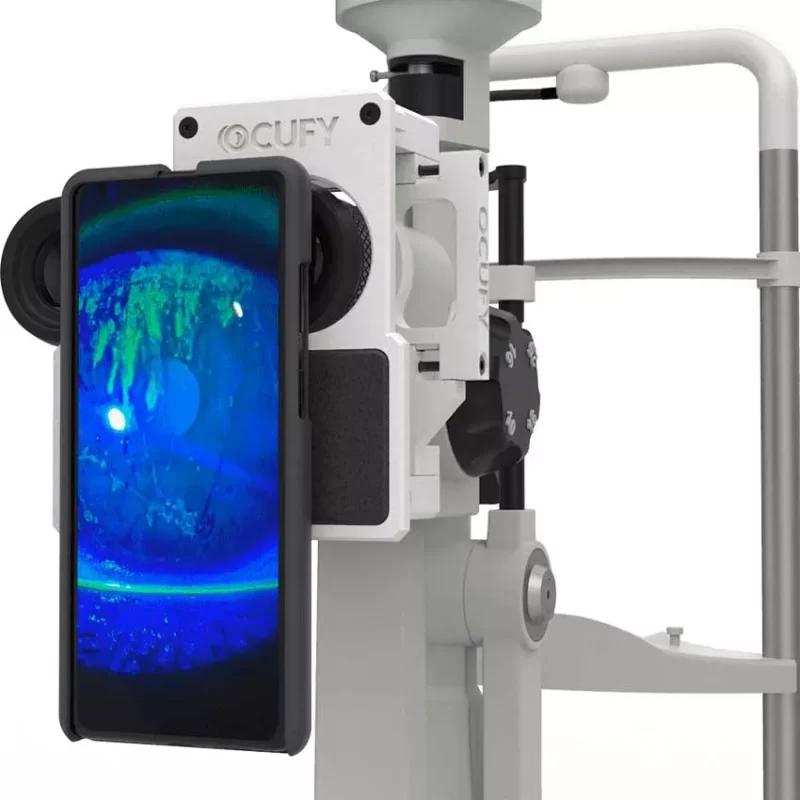 OCUFY: Soporte digitalizador para lámpara de hendidura - Imagen 3