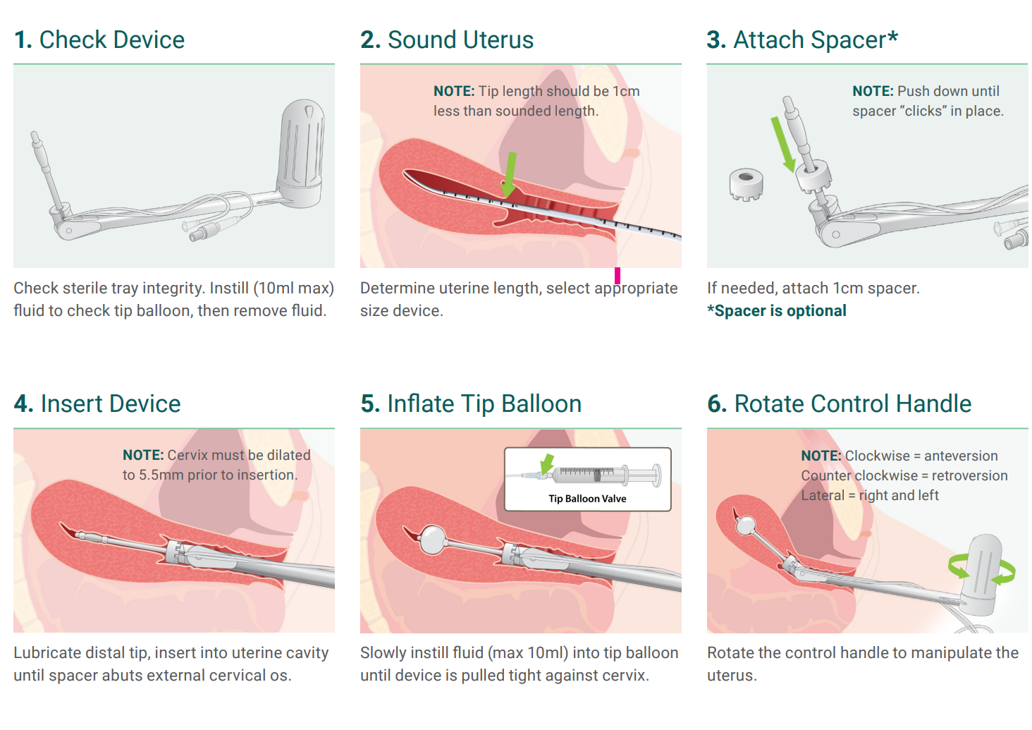 ClearView®: Manipulador Uterino Descartable para Cirugía Laparoscópica - Imagen 2