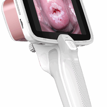 Cámara CerviCARE AI para detección de lesiones cervicouterinas