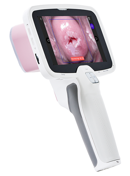 CerviCARE AI: Detección de Lesiones Cervicouterinas con Inteligencia Artificial - Imagen 5