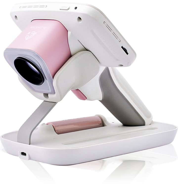 CerviCARE AI: Detección de Lesiones Cervicouterinas con Inteligencia Artificial - Imagen 2