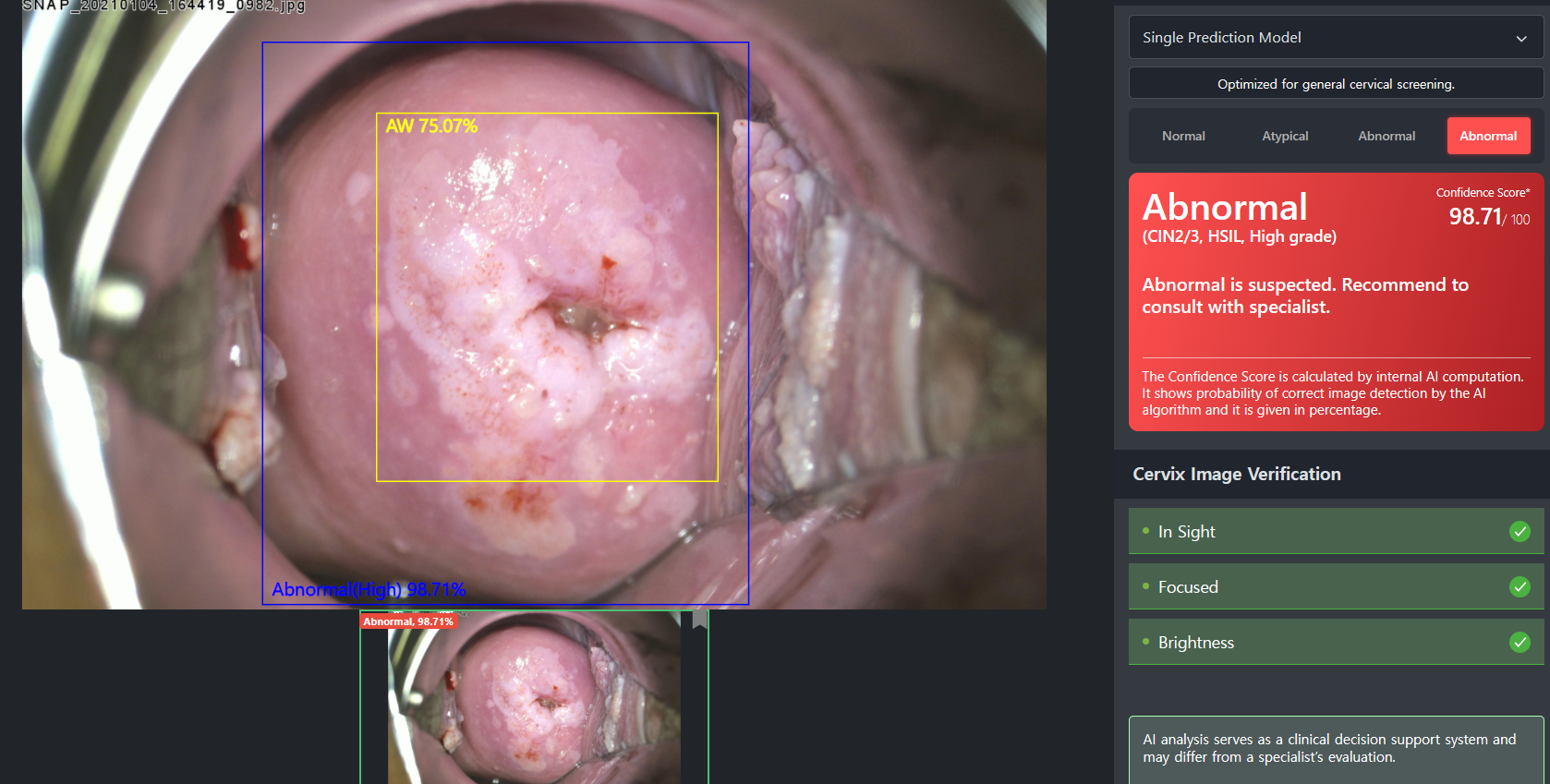CerviCARE AI: Detección de Lesiones Cervicouterinas con Inteligencia Artificial - Imagen 7